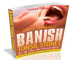 Banish Tonsil Stones Promo